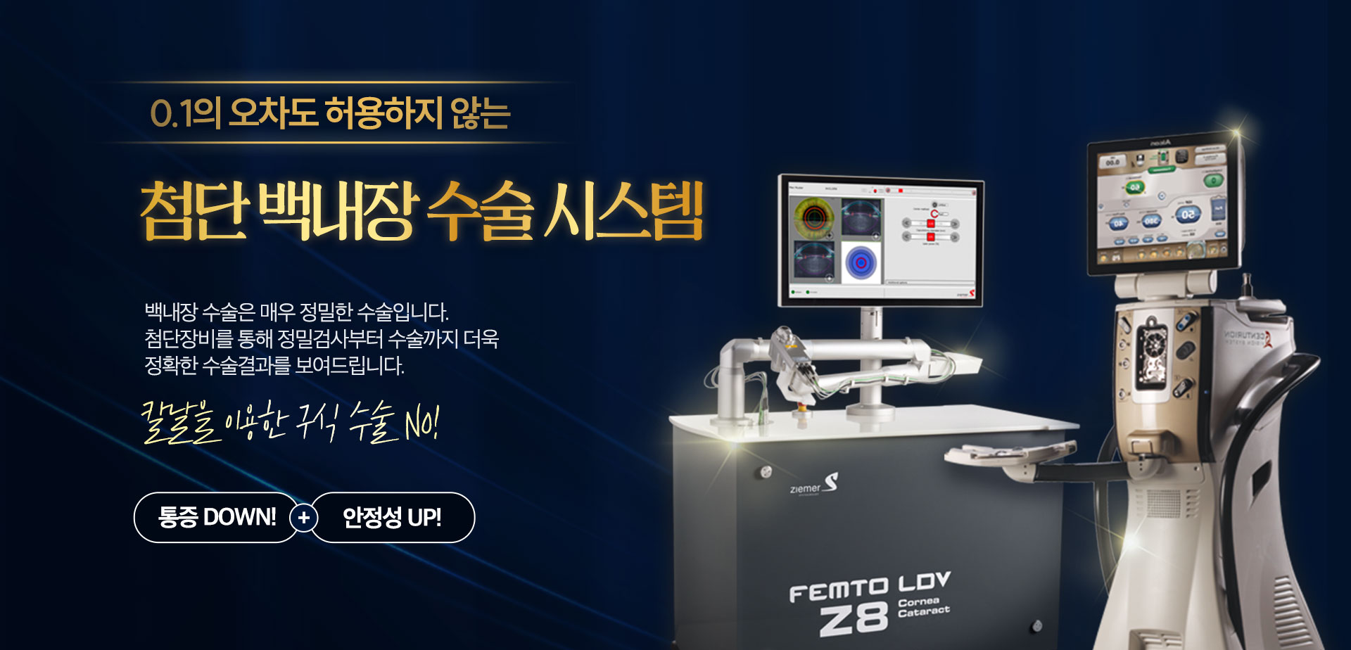 첨단 백내장 수술 시스템